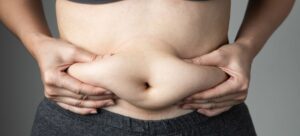 Cellulite vs. Fat: Understanding the Differences